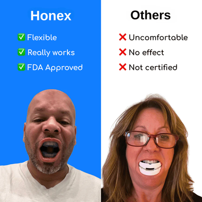 Honex Anti-Snoring Mouthpiece